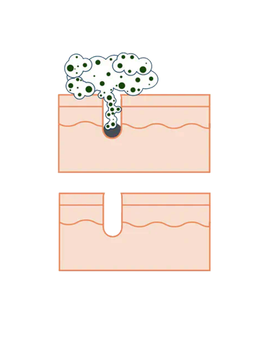 DERMASTIR Tsunami Cleanser | Detergente Viso Profondo Airless