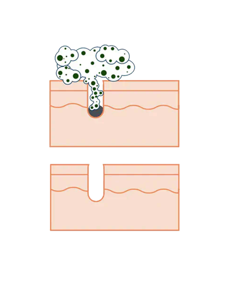 DERMASTIR TSUNAMI | Detergente Profondo